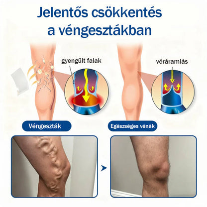 ✅ Medistart® Visszérápoló Mikrotűs Gondozó Tapasz ⚡ Azonnali Megkönnyebbülés, Hosszú Távú Eredmények