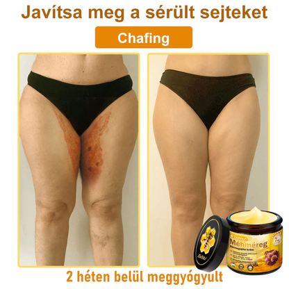 👍🔥🔥ZödVita® Méhméreg Bőr Helyreállító Krém (👨‍⚕‍CE Tanúsítvány)👍👍