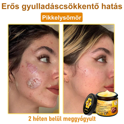 👍🔥🔥ZödVita® Méhméreg Bőr Helyreállító Krém (👨‍⚕‍CE Tanúsítvány)👍👍