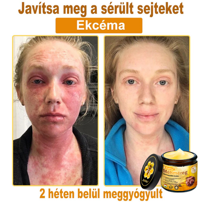 👍🔥🔥ZödVita® Méhméreg Bőr Helyreállító Krém (👨‍⚕‍CE Tanúsítvány)👍👍