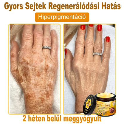 👍🔥🔥ZödVita® Méhméreg Bőr Helyreállító Krém (👨‍⚕‍CE Tanúsítvány)👍👍