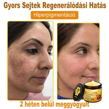 👍🔥🔥ZödVita® Méhméreg Bőr Helyreállító Krém (👨‍⚕‍CE Tanúsítvány)👍👍